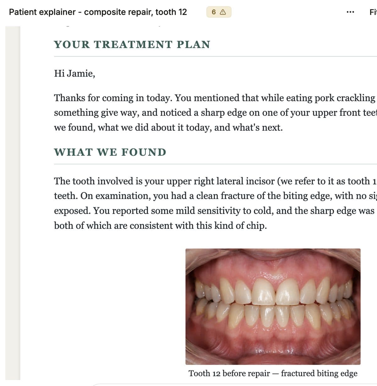 A ChairScribe patient explainer for a composite repair on tooth 12